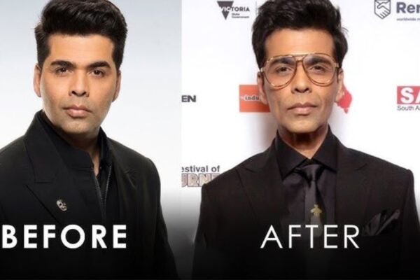 Did Karan Johar Use Ozempic as A Weight Loss Help,The Creator Was True