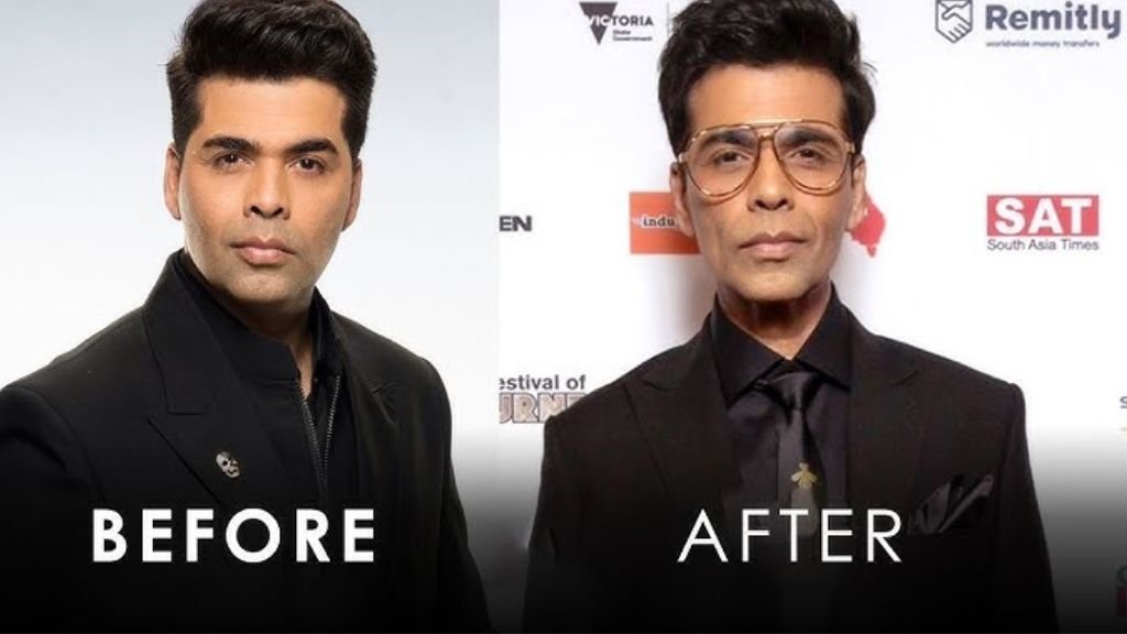 Did Karan Johar Use Ozempic as A Weight Loss Help,The Creator Was True